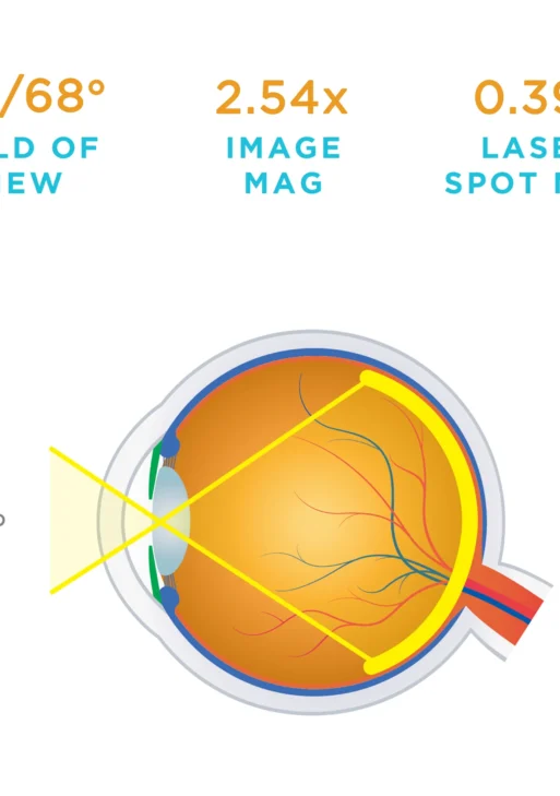 Lente Volk® 25D BIO