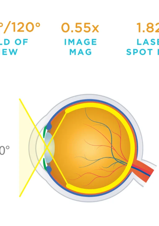 Lente Volk® Quad Pediatric