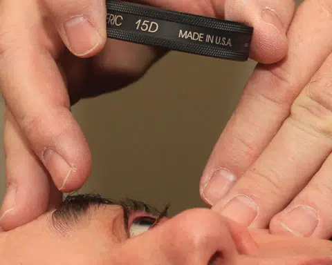 Lente Volk® 15D BIO