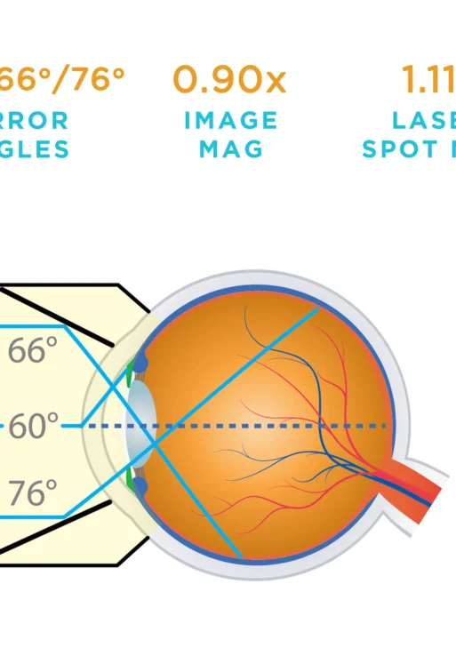 Lente Volk® 3 Specchi monouso