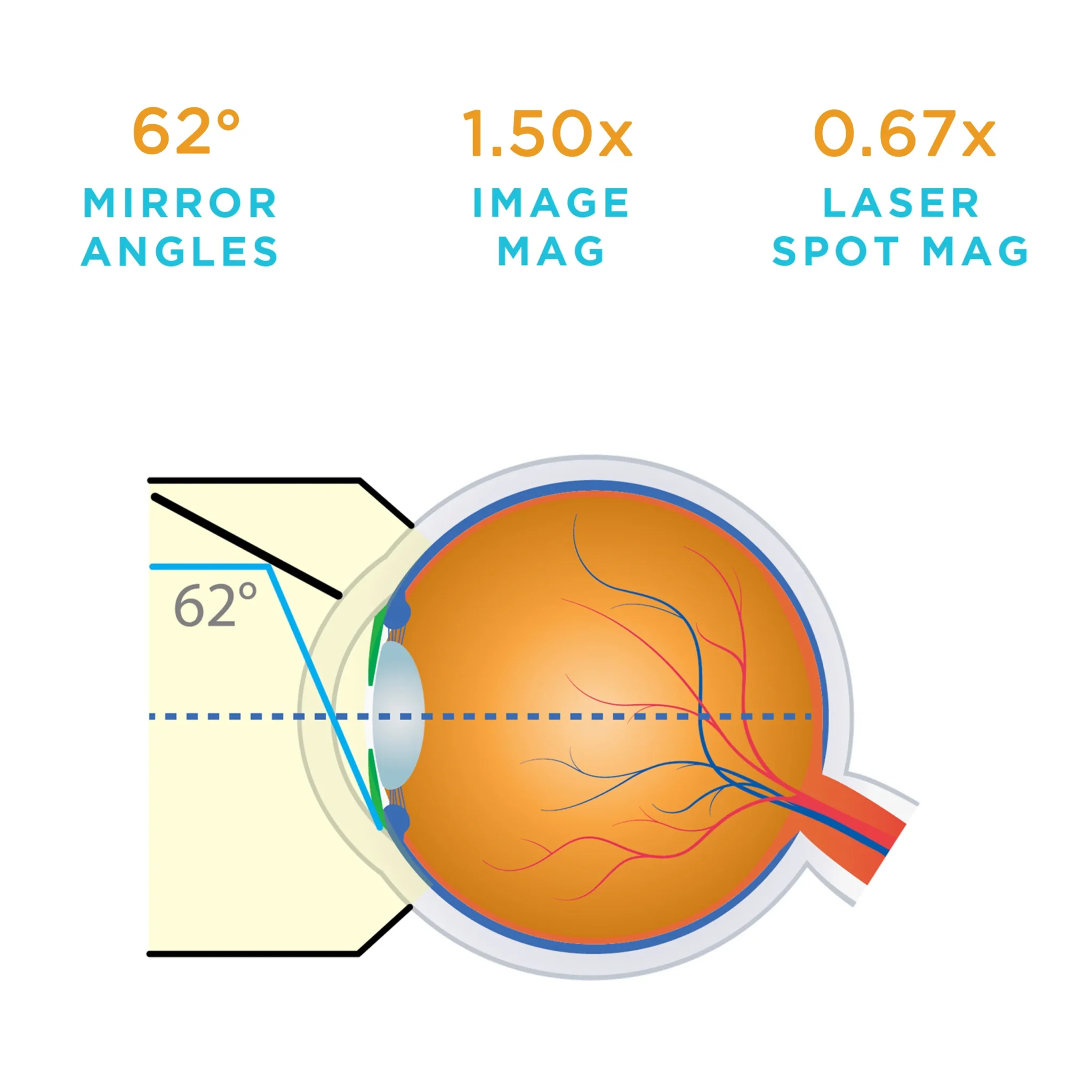 Lente Volk® Gonio G-1 - immagine 2