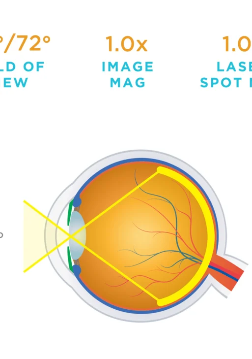 Lente Volk® Digital Imaging 1.0X