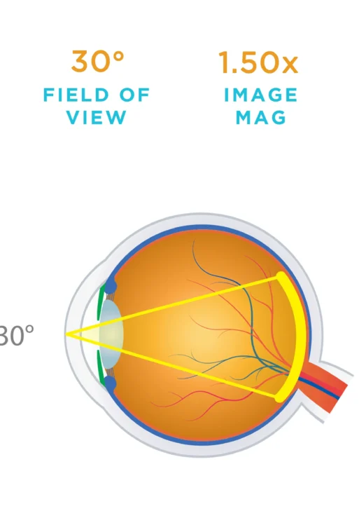 Lente Volk® monouso magnifying (1 confezione da 10)