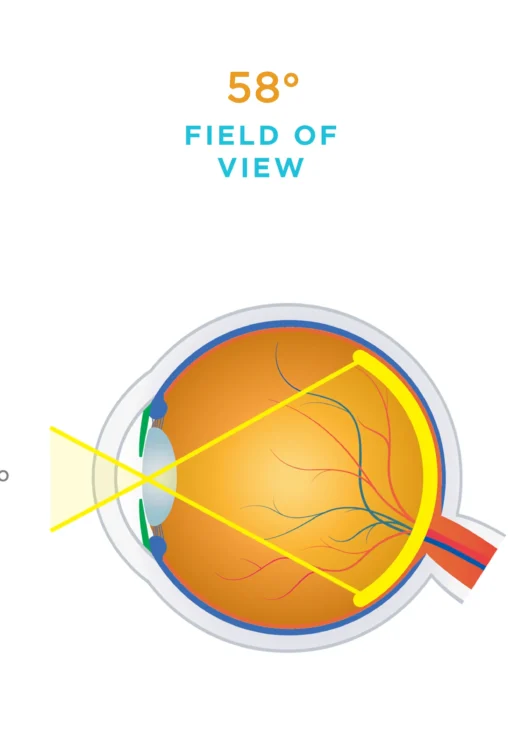Lente Volk® monouso 20D (1 confezione da 10)