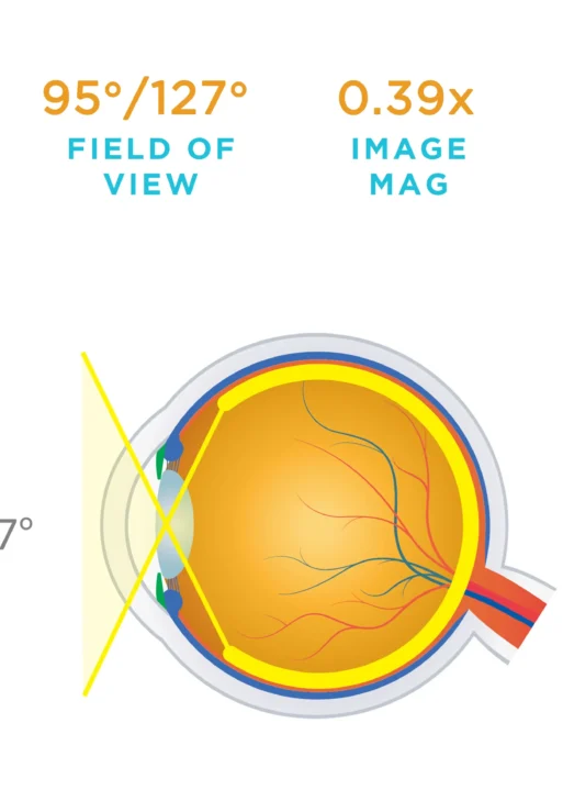 Lente Volk® DynaView