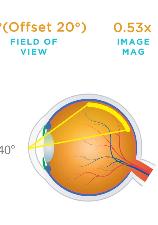 Lente Volk® HR Direct 20 Prism