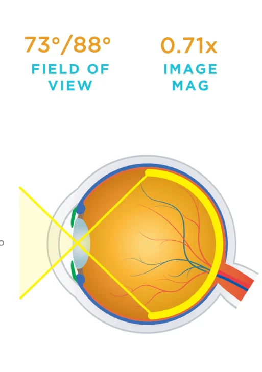 Lente Volk® Central Retinal
