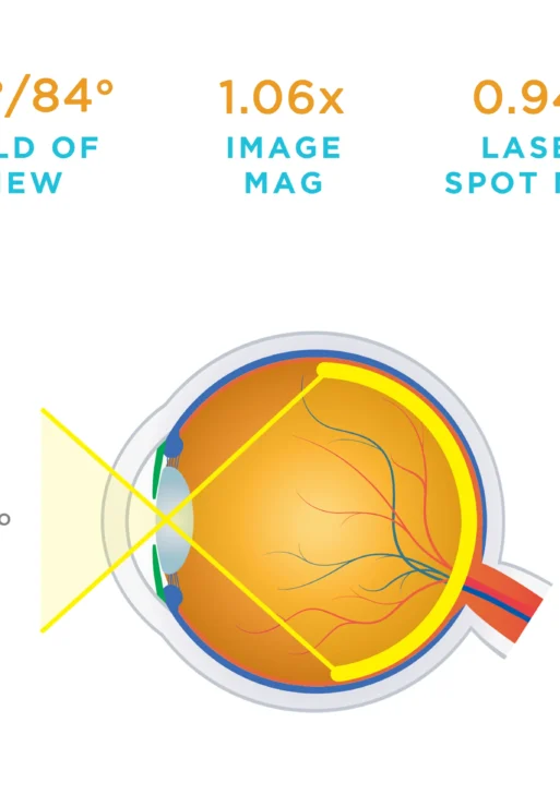 Lente Volk® Area Centralis®