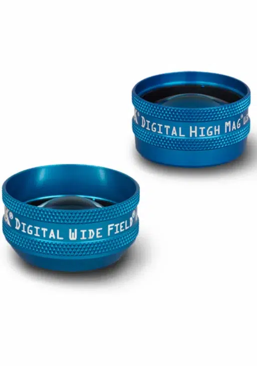 Set Serie Digital Lens da 2 pezzi